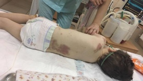 У Кременчуці помер побитий вітчимом хлопчик