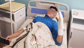 У ліцеї Нових Санжар побили 17-річного учня: мати заявляє про бездіяльність поліції